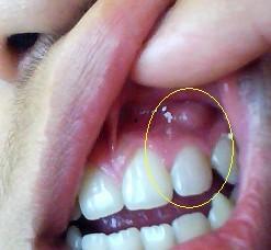 吃土瓜牙床肿,探究成因与缓解之道